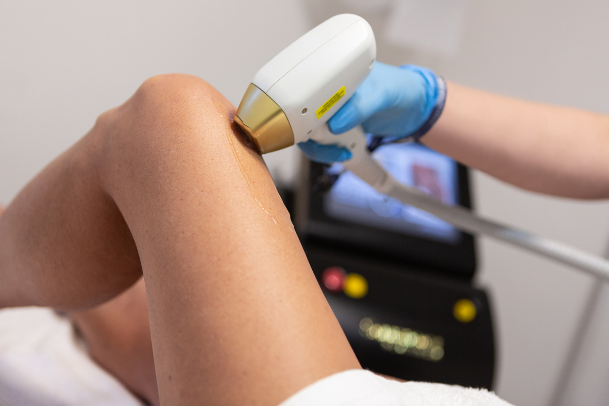 The truth about laser hair removal